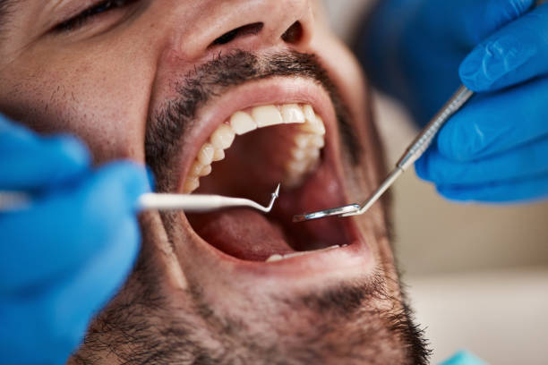 Best Mobile Emergency Dentist in Waupaca, WI